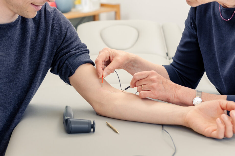 Mit einem elektrischen Gerät wird die Narbe am Arm eines Mannes behandelt | Physiotherapie Schmeddes